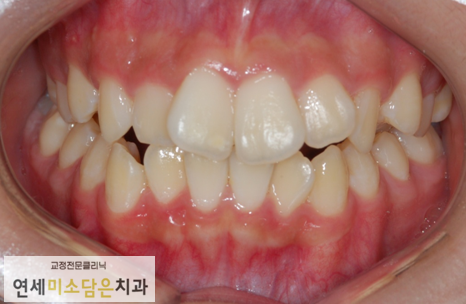연세미소담은치과 이미지