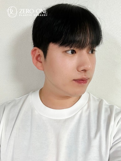 굿바이콤플렉스 이미지