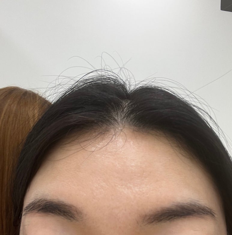 브로우리즈 이미지