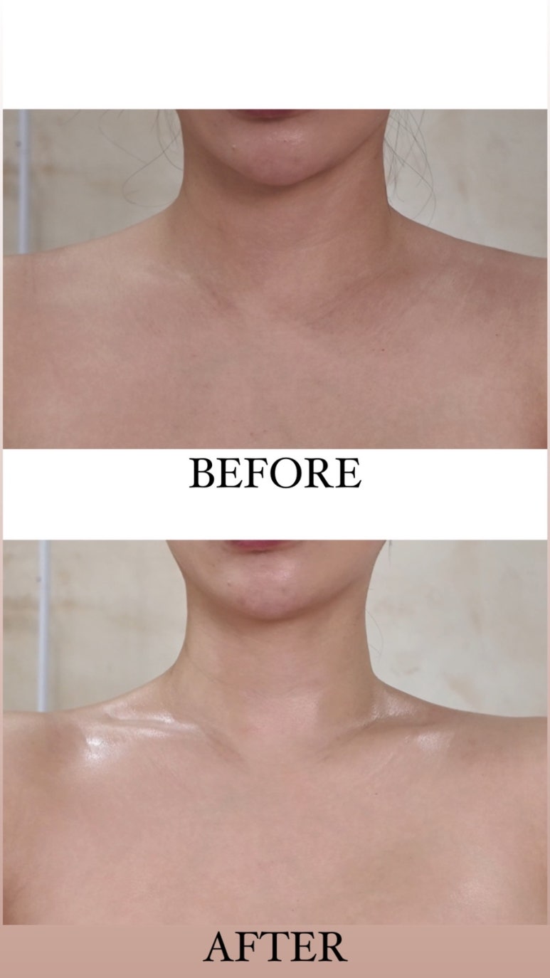 프로우 이미지