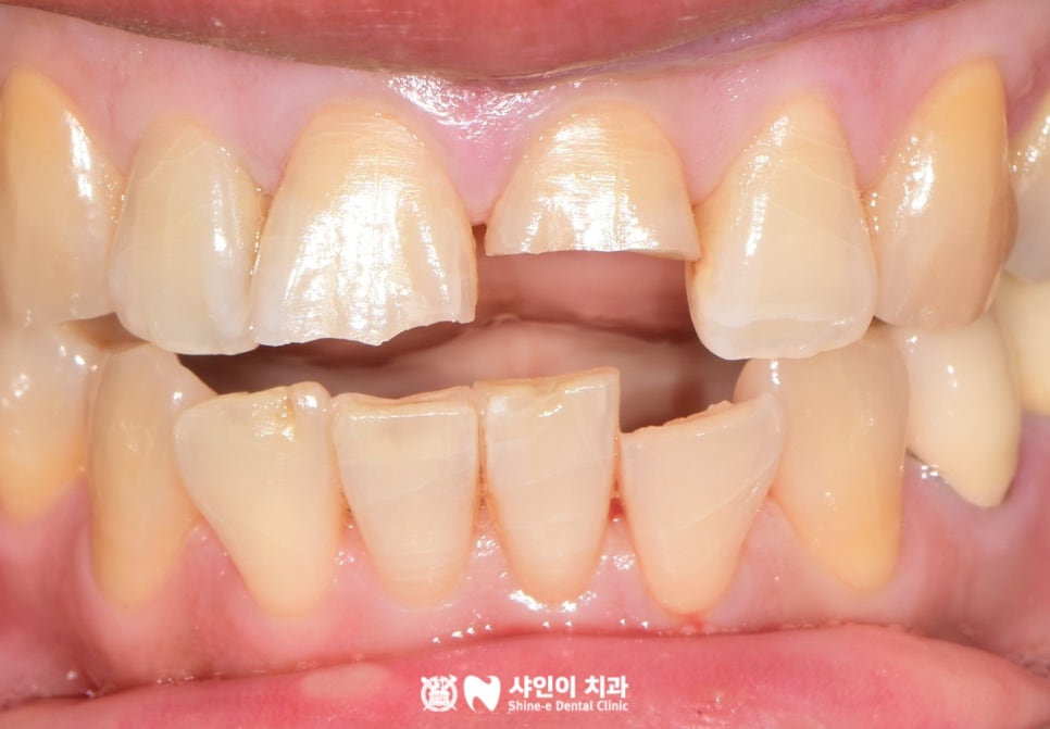 샤인이치과의원 이미지