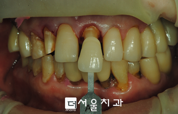 구의본치과 이미지