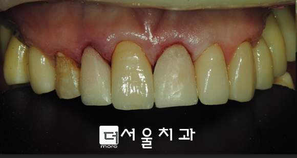 구의본치과 이미지