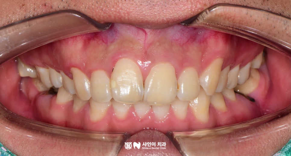 샤인이치과의원 이미지