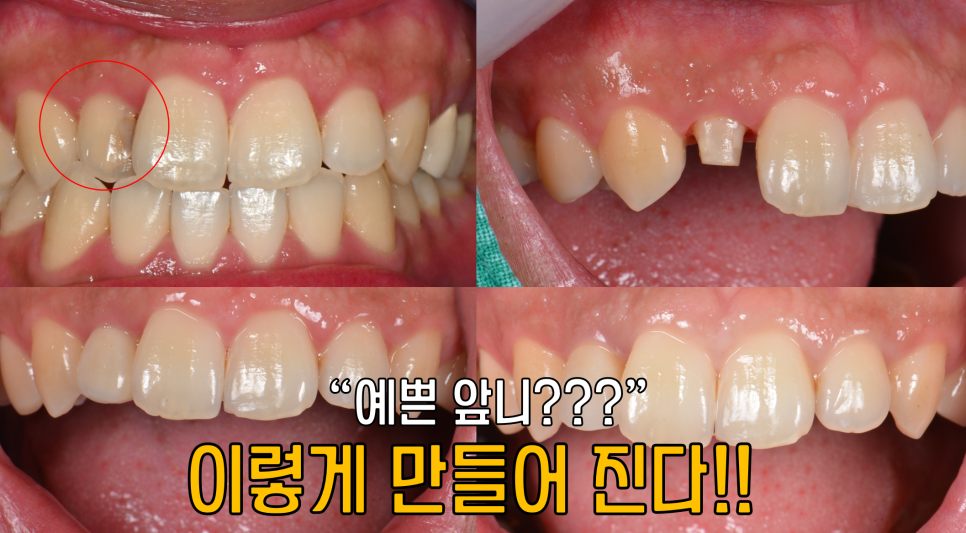 뉴욕굿모닝치과의원 이미지