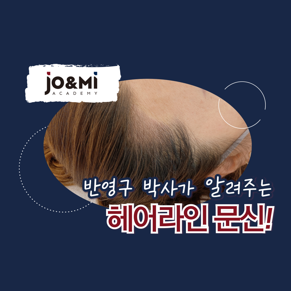 권헤어라인 이미지