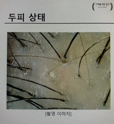 청정문경케어 이미지