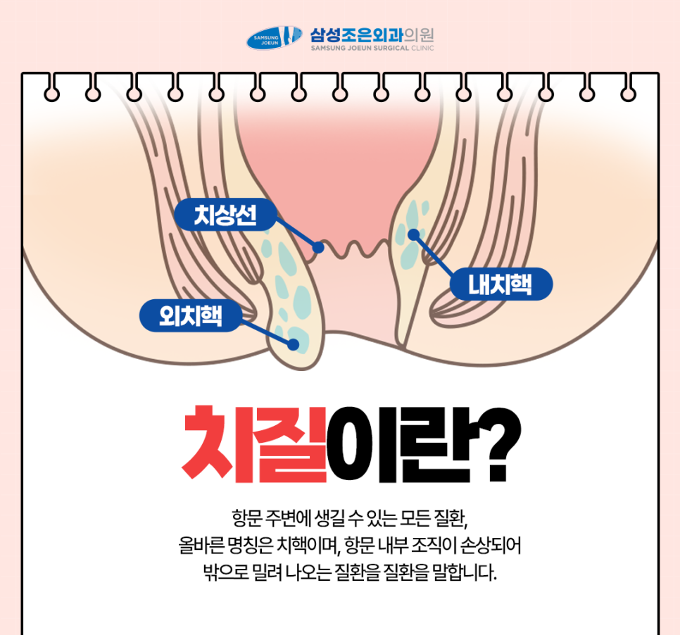삼성조은외과 이미지