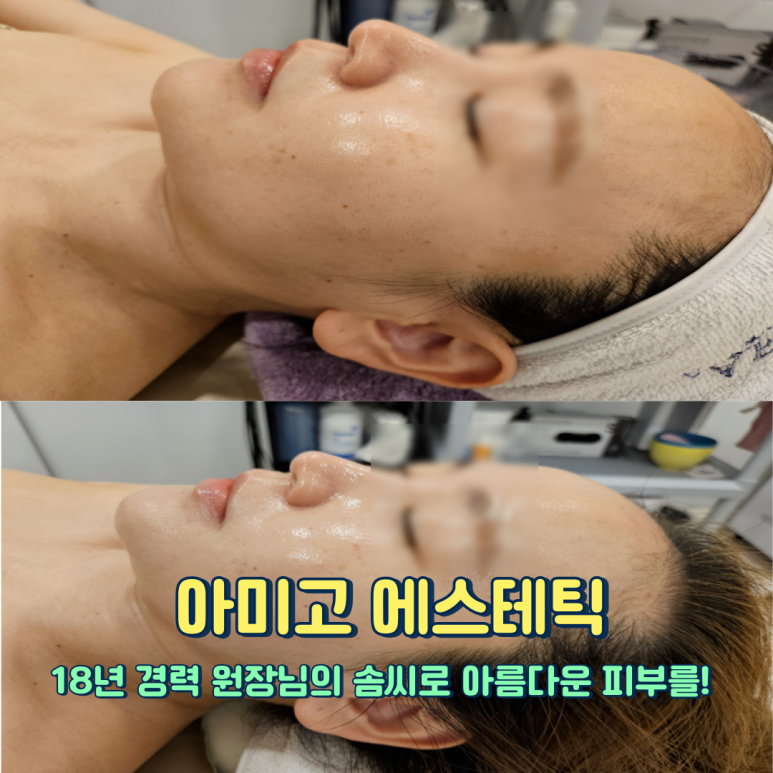 아미고에스테틱 이미지
