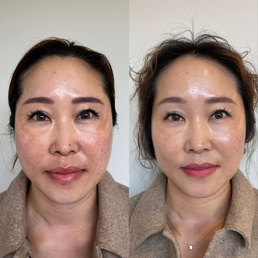 미백피부샵 이미지