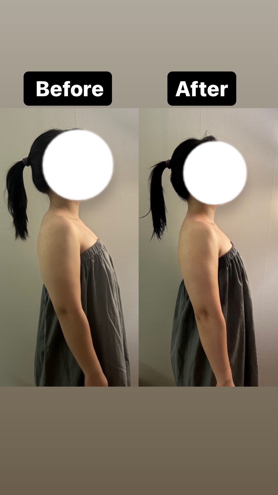 올바디테라피 이미지