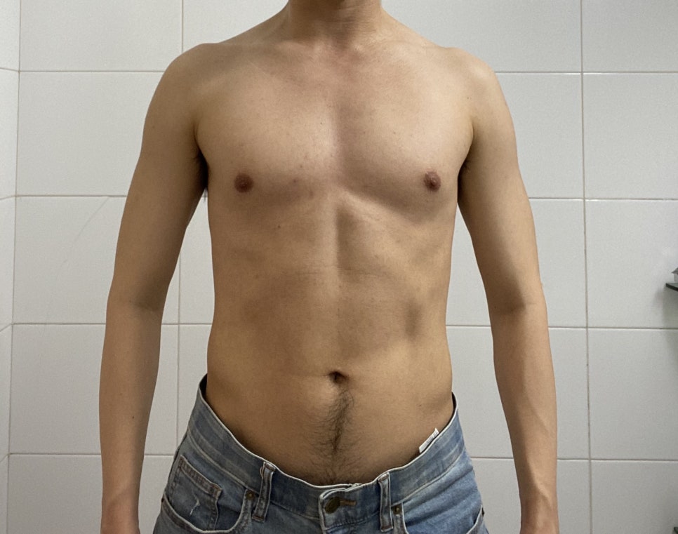 비포에프터 이미지