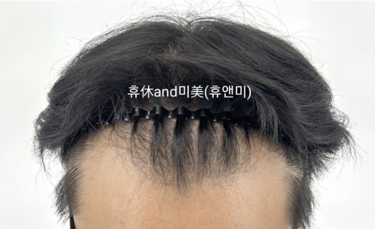 휴&미헤어 이미지