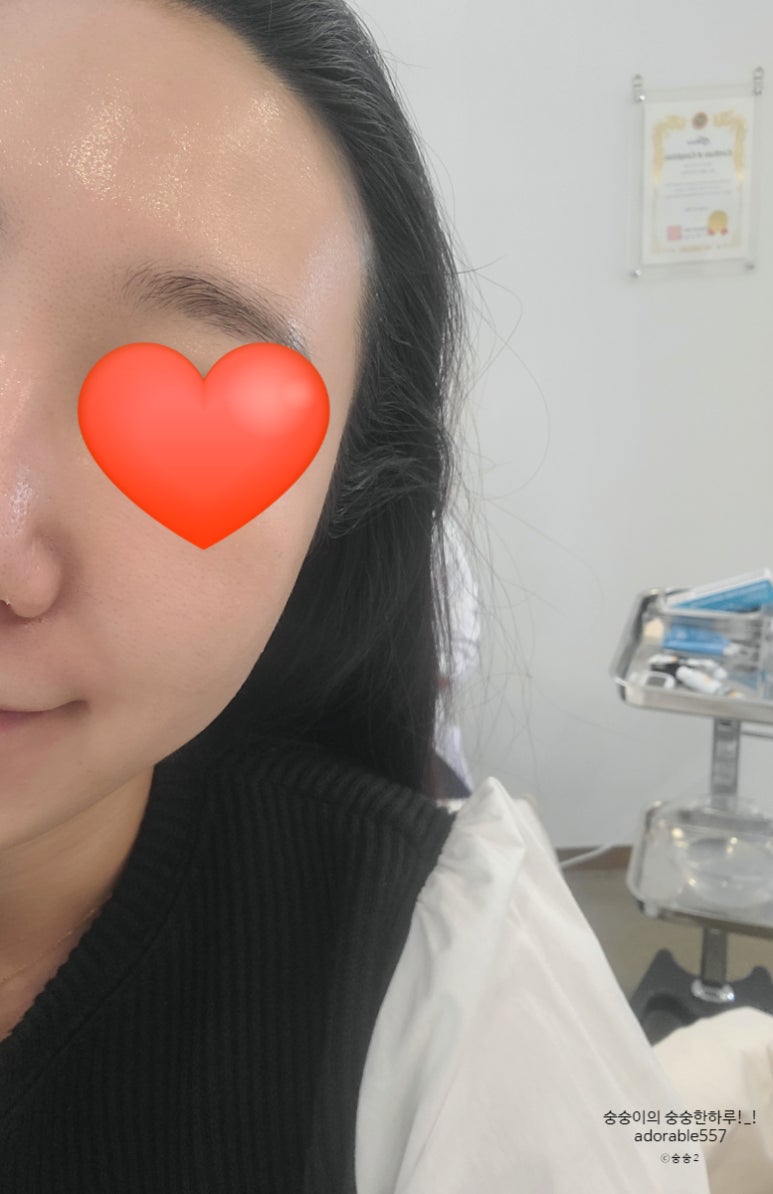 제이 에스티지 이미지