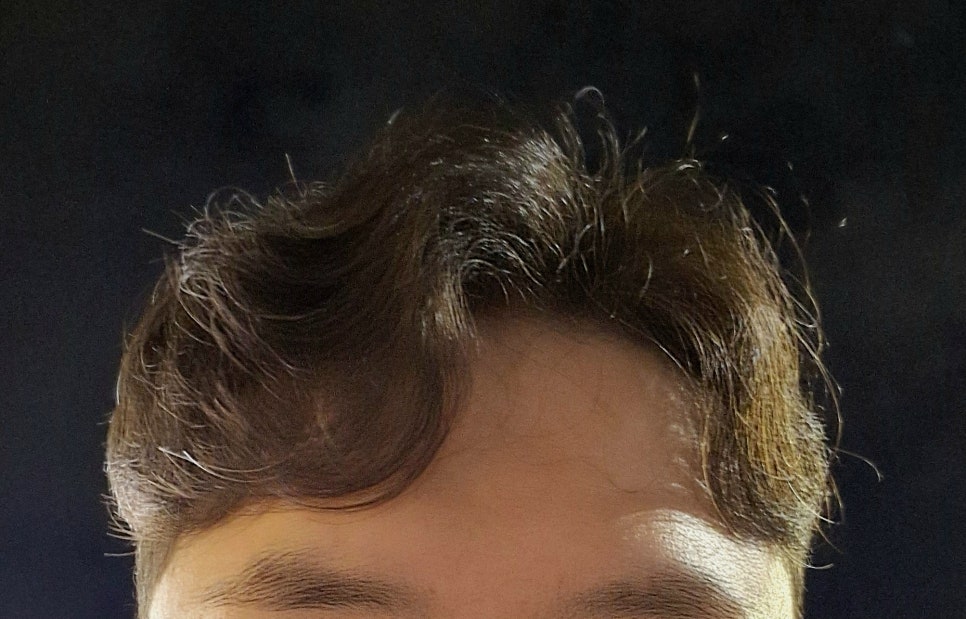 크로플럽 이미지
