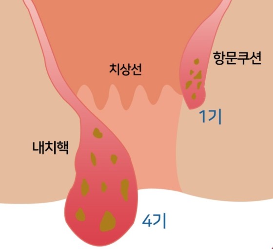 유항외과 이미지