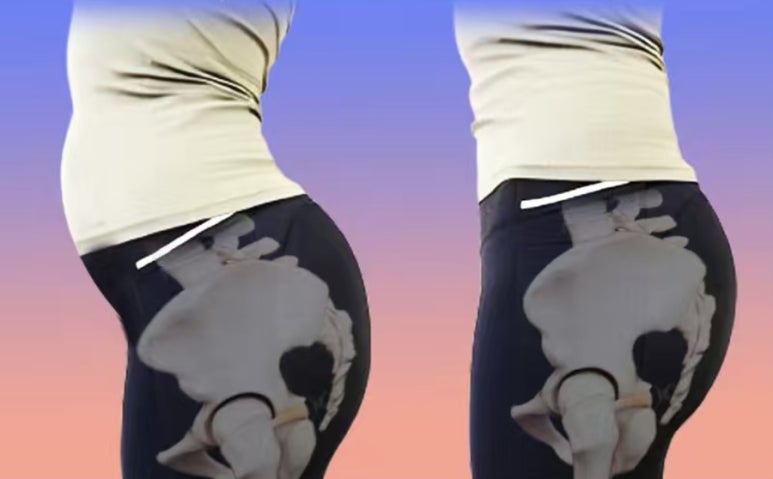 천안체형관리 이미지