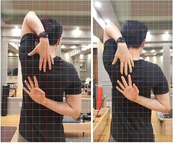 르메드 이미지