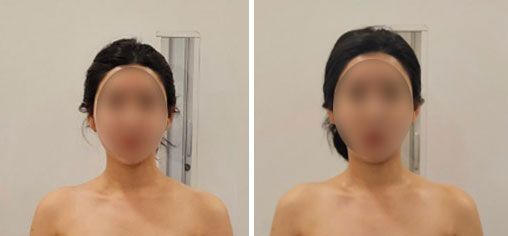 허치벨 이미지