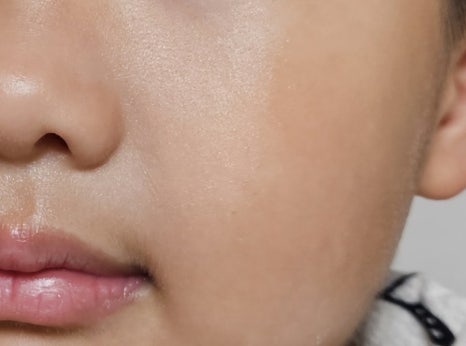 로로스킨케어 이미지