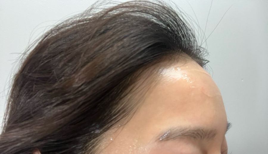 뷰티 썸 스킨 이미지