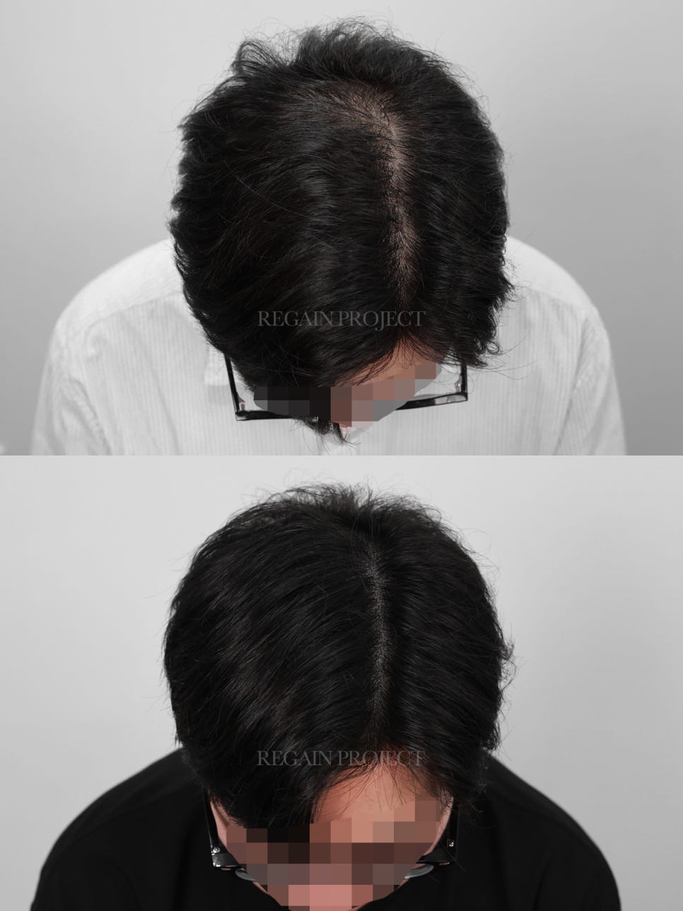 리게인프로젝트 이미지