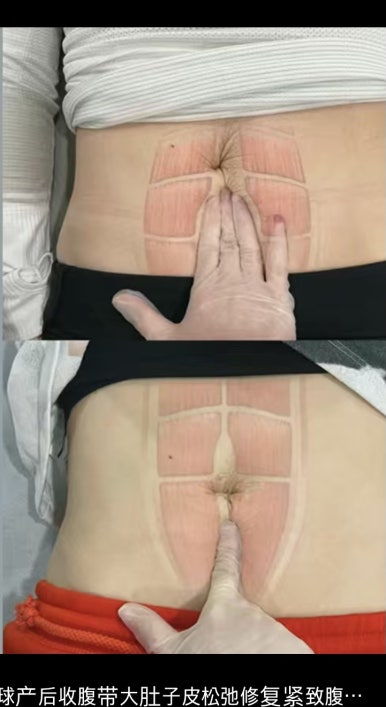 천안체형관리 이미지