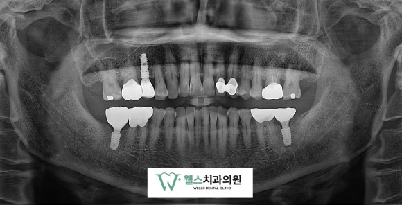 웰스치과의원개포 이미지