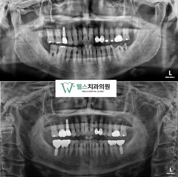 웰스치과의원개포 이미지