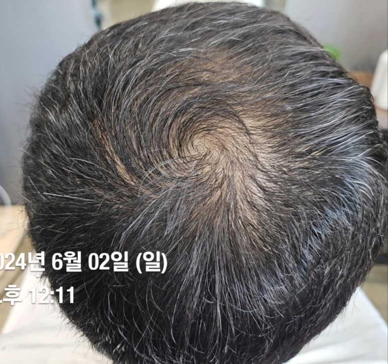 벨류헤어 이미지