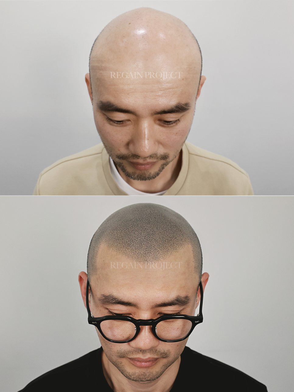 리게인프로젝트 이미지