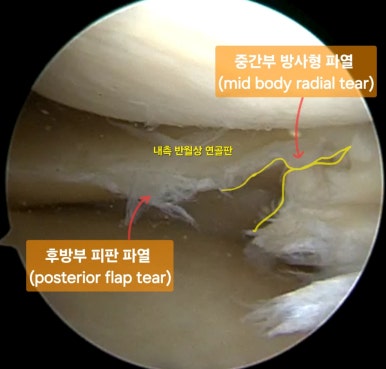 강서방사 이미지
