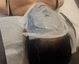 앨빈스킨케어 이미지
