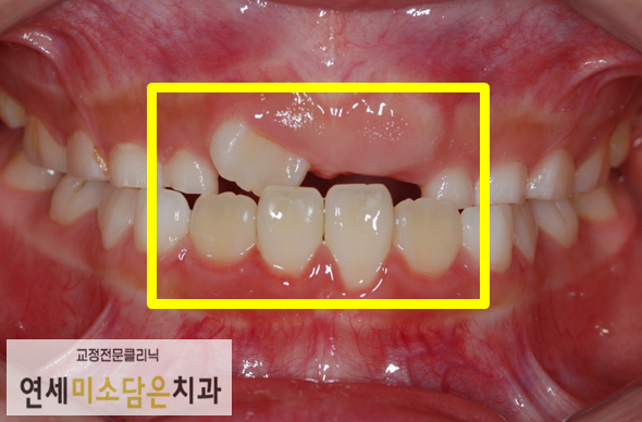 연세미소담은치과 이미지
