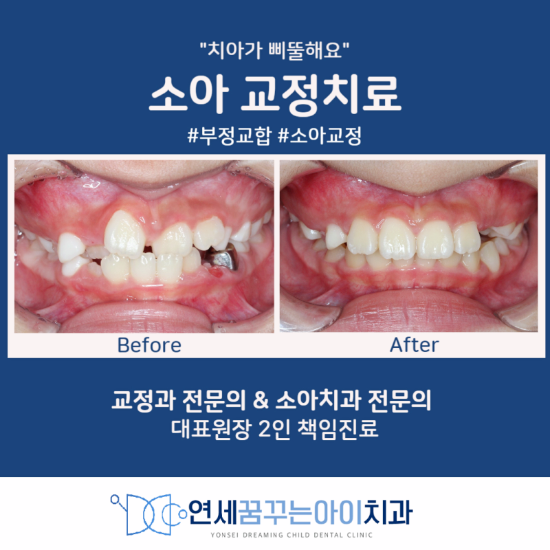 연세세브란스치과의원 이미지