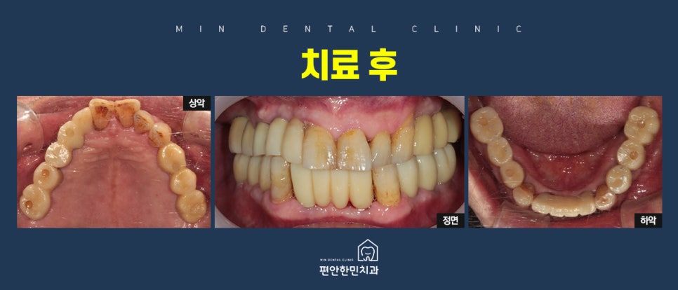 편안한민치과 이미지