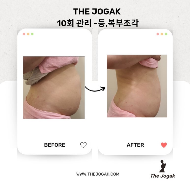 더조각테라피 이미지