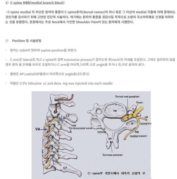지블록 이미지