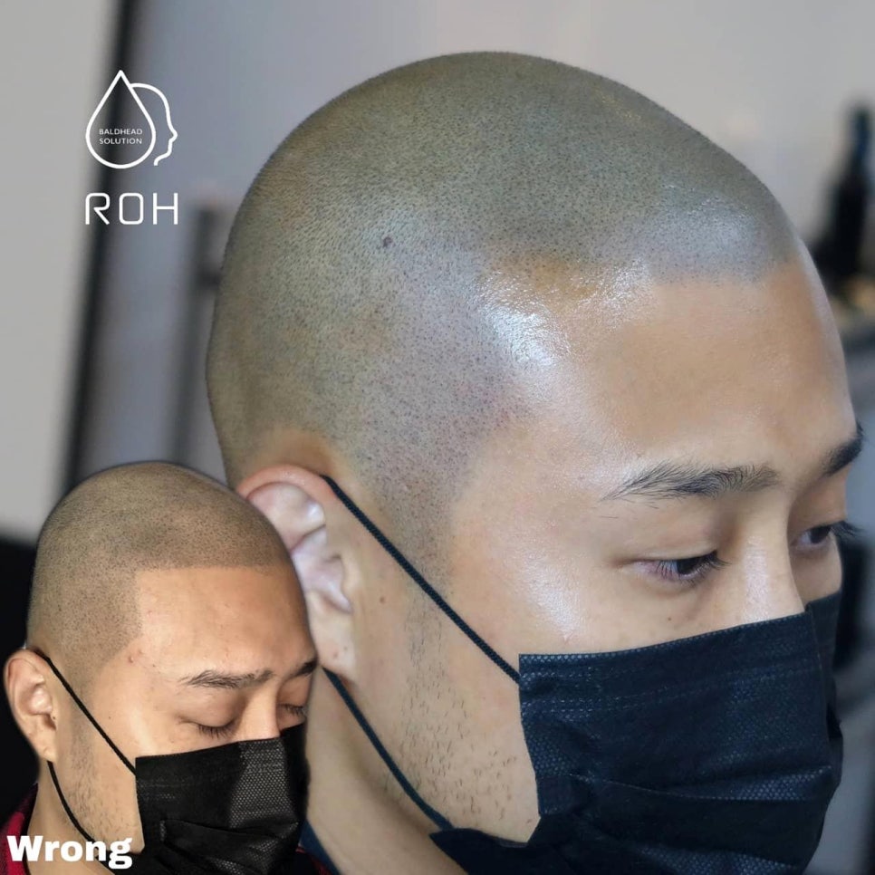 프로스칼프부산 이미지