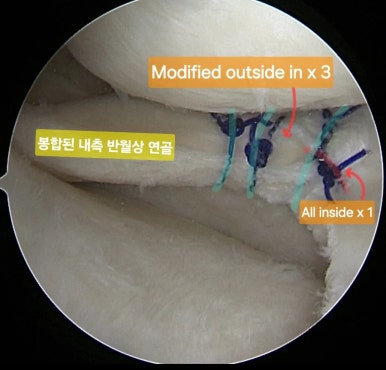 강서방사 이미지