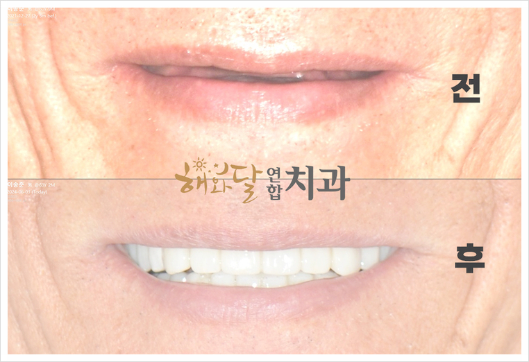 해와달연합치과 이미지