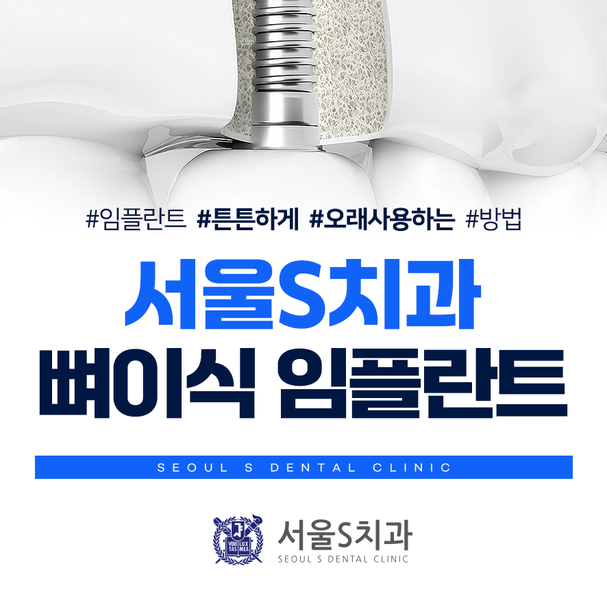 서울에스의원 이미지