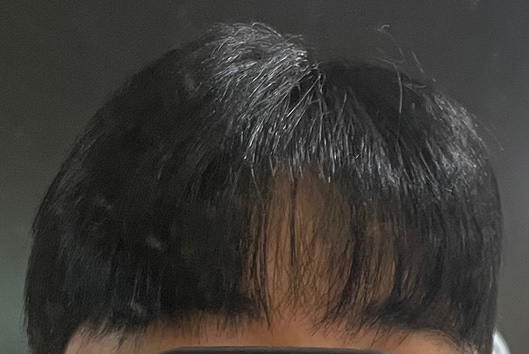 뽀르뚜아헤어 이미지