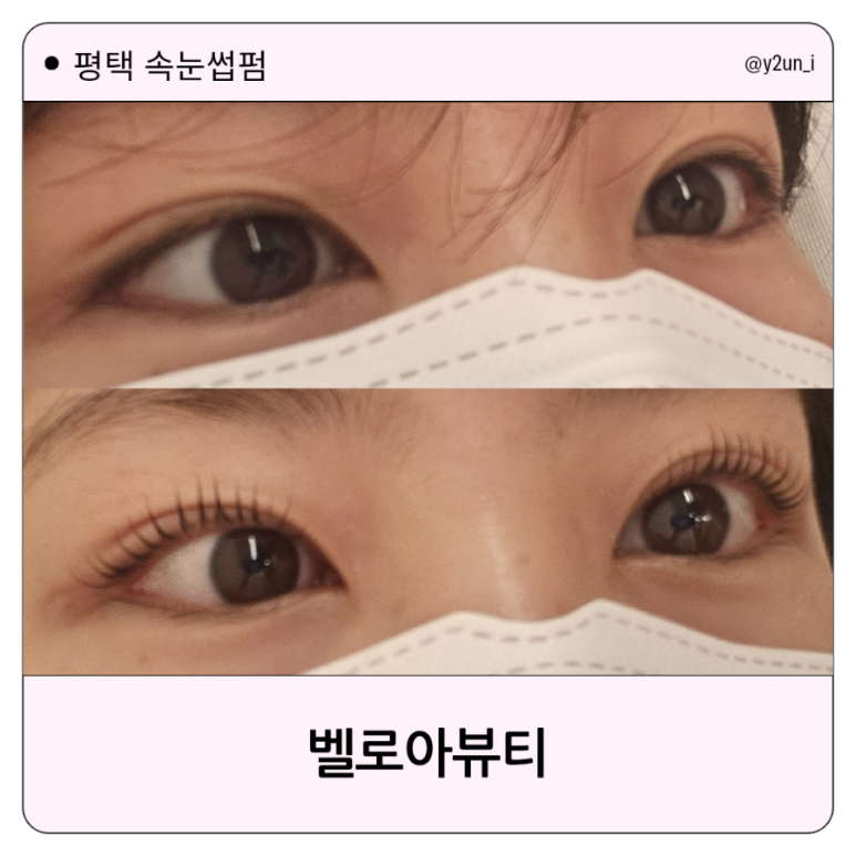 벨로아뷰티 이미지