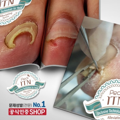 엘네일 이미지