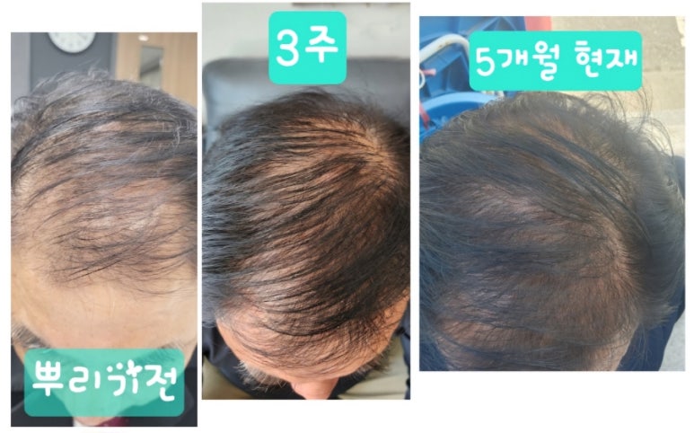 헤어달 이미지