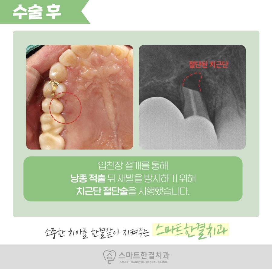 스마트한결치과 이미지