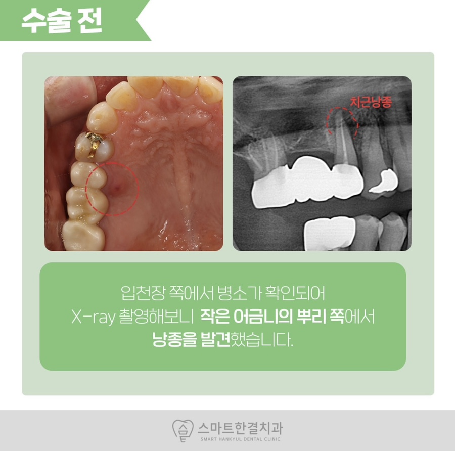 스마트한결치과 이미지