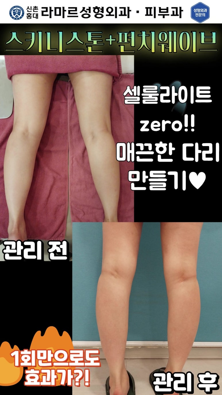 신촌홍대라마르성형외과의원 이미지