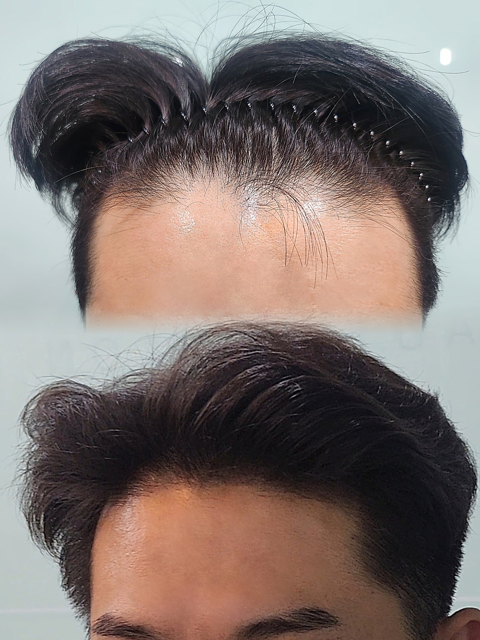 정 헤어라인 이미지